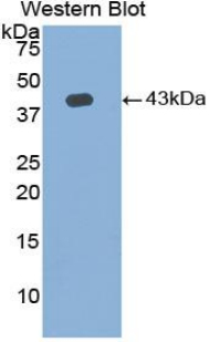 AQP2 / Aquaporin 2 Antibody - Western blot of recombinant AQP2 / Aquaporin 2.  This image was taken for the unconjugated form of this product. Other forms have not been tested.