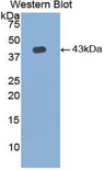AQP2 / Aquaporin 2 Antibody - Western blot of recombinant AQP2 / Aquaporin 2.  This image was taken for the unconjugated form of this product. Other forms have not been tested.