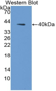 AQP2 / Aquaporin 2 Antibody - Western Blot; Sample: Recombinant protein.