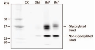 AQP2 / Aquaporin 2 Antibody - Detection of Aquaporin 2 in rat kidney extracts. Key: CX=Cortex, OM=Outer Medulla, IMB =Inner Medulla Base, IMP = Inner Medulla Papilla.  This image was taken for the unconjugated form of this product. Other forms have not been tested.