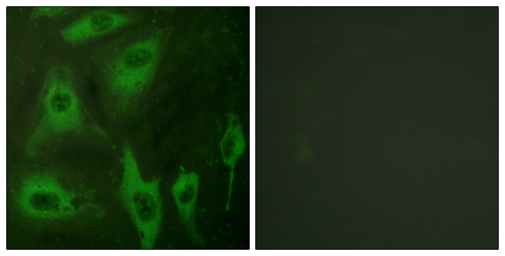 AQP2 / Aquaporin 2 Antibody - Immunofluorescence analysis of HeLa cells, using Aquaporin 2 Antibody. The picture on the right is blocked with the synthesized peptide.