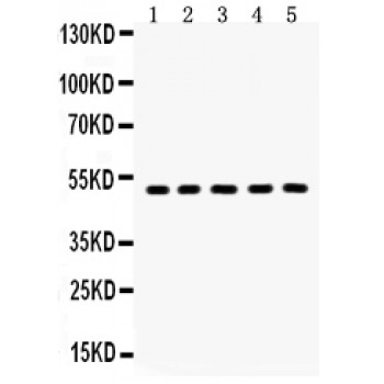 AQP2 / Aquaporin 2 Antibody - Aquaporin 2 antibody Western blot. All lanes: Anti Aquaporin 2 at 0.5 ug/ml. Lane 1: Rat Kidney Tissue Lysate at 50 ug. Lane 2: Mouse Kidney Tissue Lysate at 50 ug. Lane 3: HELA Whole Cell Lysate at 40 ug. Lane 4: A549 Whole Cell Lysate at 40 ug. Lane 5: PANC Whole Cell Lysate at 40 ug. Predicted band size: 29 kD. Observed band size: 50 kD.