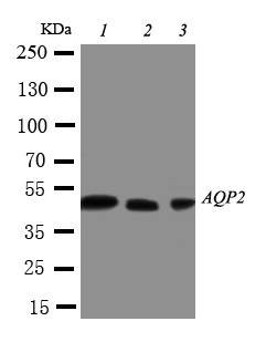 AQP2 / Aquaporin 2 Antibody - WB of AQP2 / Aquaporin 2 antibody. Lane 1: MCF-7 Cell Lysate. Lane 2: SW620 Cell Lysate. Lane 3: HT1080 Cell Lysate.