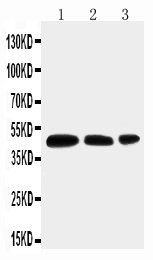 AQP2 / Aquaporin 2 Antibody - Anti-Aquaporin 2 antibody, Western blotting Lane 1: MCF-7 Cell LysateLane 2: SW620 Cell LysateLane 3: HT1080 Cell Lysate