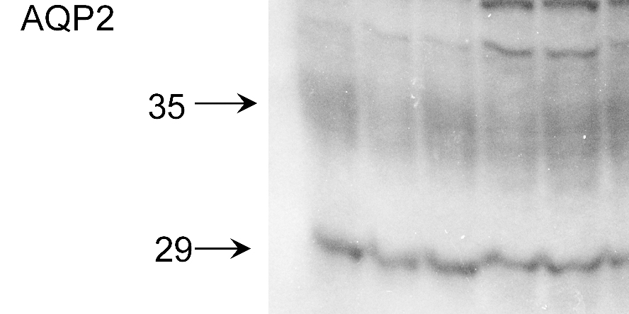 AQP2 / Aquaporin 2 Antibody - Western blot analysis of Aquaporin 2 in rat kidney tissue using a 1 in 2000 dilution of AQP2 / Aquaporin 2 antibody, showing glyco and non-glycosylated bands.