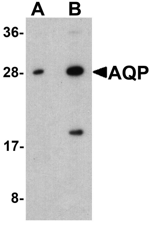 AQP2 / Aquaporin 2 Antibody - Western blot analysis of AQP2 in A431 cell lysate with AQP2 antibody at (A) 1 and (B) 2 ug/ml.