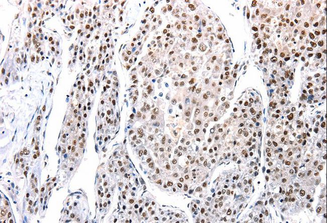 AQP2 / Aquaporin 2 Antibody - Immunohistochemistry of paraffin-embedded Human tonsil using AQP2 Polyclonal Antibody at dilution of 1:100.