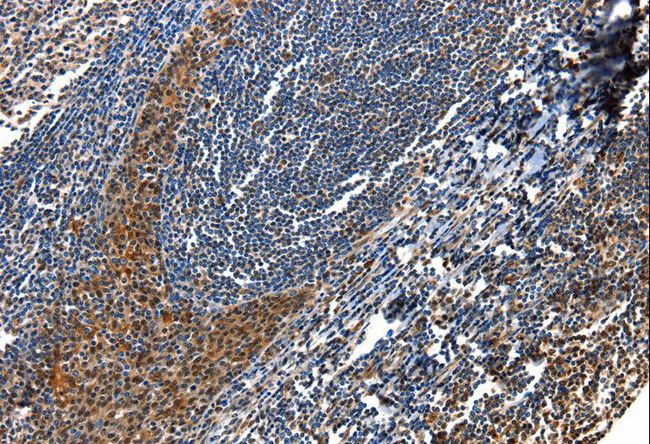AQP2 / Aquaporin 2 Antibody - Immunohistochemistry of paraffin-embedded Human tonsil using AQP2 Polyclonal Antibody at dilution of 1:100.
