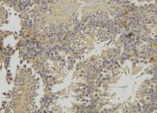 AQP2 / Aquaporin 2 Antibody - 1:100 staining mouse testis tissue by IHC-P. The sample was formaldehyde fixed and a heat mediated antigen retrieval step in citrate buffer was performed. The sample was then blocked and incubated with the antibody for 1.5 hours at 22°C. An HRP conjugated goat anti-rabbit antibody was used as the secondary.