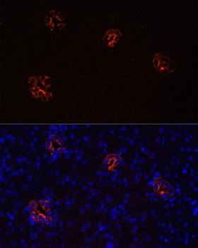 AQP2 / Aquaporin 2 Antibody - Immunofluorescence analysis of Rat kidney cells using AQP2 Polyclonal Antibody at dilution of 1:100.Blue: DAPI for nuclear staining.