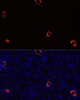 AQP2 / Aquaporin 2 Antibody - Immunofluorescence analysis of Mouse kidney cells using AQP2 Polyclonal Antibody at dilution of 1:100.Blue: DAPI for nuclear staining.
