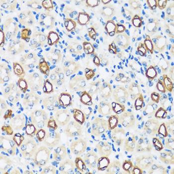 AQP2 / Aquaporin 2 Antibody - Immunohistochemistry of paraffin-embedded Mouse kidney using AQP2 Polyclonal Antibody at dilution of 1:100 (40x lens).