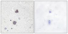 AQP2 / Aquaporin 2 Antibody - Immunohistochemistry analysis of paraffin-embedded human brain, using Aquaporin 2 (Phospho-Ser256) Antibody. The picture on the right is blocked with the phospho peptide.