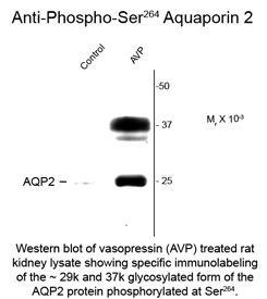AQP2 / Aquaporin 2 Antibody