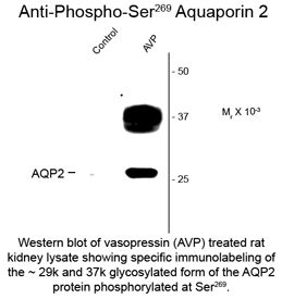AQP2 / Aquaporin 2 Antibody