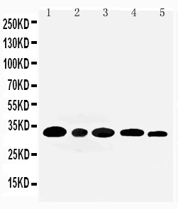 AQP3 / Aquaporin 3 Antibody - WB of AQP3 / Aquaporin 3 antibody. All lanes: Anti-AQP3 at 0.5ug/ml. Lane 1: Rat Kidney Tissue Lysate at 40ug. Lane 2: Rat Lung Tissue Lysate at 40ug. Lane 3: Mouse Kidney Tissue Lysate at 40ug. Lane 4: M453 Whole Cell Lysate at 40ug. Lane 5: MMC Whole Cell Lysate at 40ug. Predicted bind size: 32KD. Observed bind size: 32KD.
