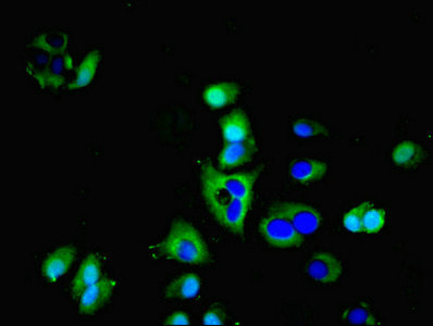 AQP3 / Aquaporin 3 Antibody - Immunofluorescent analysis of Hela cells using AQP3 Antibody at dilution of 1:100 and Alexa Fluor 488-congugated AffiniPure Goat Anti-Rabbit IgG(H+L)