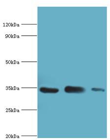 AQP4 / Aquaporin 4 Antibody - Western blot. All lanes: Aquaporin-4 antibody at 2 ug/ml. Lane 1: mouse brain tissue. Lane 2: mouse heart tissue. Lane 3: mouse kidney tissue. Secondary antibody: Goat polyclonal to rabbit at 1:10000 dilution. Predicted band size: 35 kDa. Observed band size: 35 kDa.