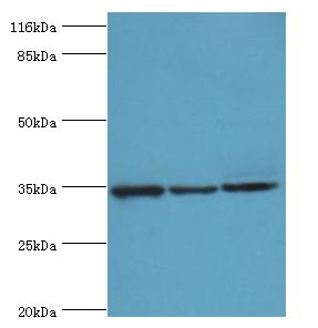 AQP4 / Aquaporin 4 Antibody - Western blot. All lanes: AQP4 antibody at 2 ug/ml. Lane 1: mouse heart tissue Lane 2: mouse brain tissue Lane 3: mouse kidney tissue. Secondary antibody: goat polyclonal to rabbit at 1:10000 dilution. Predicted band size: 35 kDa. Observed band size: 35 kDa.  This image was taken for the unconjugated form of this product. Other forms have not been tested.