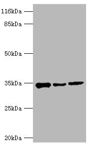 AQP4 / Aquaporin 4 Antibody - Western blot All lanes: AQP4 antibody at 2µg/ml Lane 1: Mouse heart tissue Lane 2: Mouse brain tissue Lane 3: Mouse kidney tissue Secondary Goat polyclonal to rabbit IgG at 1/10000 dilution Predicted band size: 35, 33 kDa Observed band size: 35 kDa