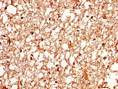 AQP4 / Aquaporin 4 Antibody - IHC image of AQP4 Antibody diluted at 1:370 and staining in paraffin-embedded human brain tissue performed on a Leica BondTM system. After dewaxing and hydration, antigen retrieval was mediated by high pressure in a citrate buffer (pH 6.0). Section was blocked with 10% normal goat serum 30min at RT. Then primary antibody (1% BSA) was incubated at 4°C overnight. The primary is detected by a biotinylated secondary antibody and visualized using an HRP conjugated SP system.