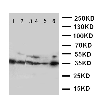 AQP4 / Aquaporin 4 Antibody - WB of AQP4 / Aquaporin 4 antibody. Lane 1: Rat Heart Tissue Lysate. Lane 2: Rat Brain Tissue Lysate. Lane 3: Rat Kidney Tissue Lysate. Lane 4: HT1080 Cell Lysate . Lane 5: MCF-7 Cell Lysate. Lane 6: COLO320 Cell Lysate.