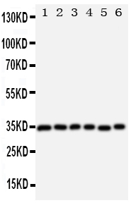AQP4 / Aquaporin 4 Antibody - Anti-Aquaporin 4 antibody, Western blotting Lane 1: Rat Heart Tissue LysateLane 2: Rat Brain Tissue LysateLane 3: Rat Kidney Tissue LysateLane 4: HT1080 Cell Lysate Lane 5: MCF-7 Cell LysateLane 6: COLO320 Cell Lysate