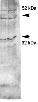 AQP4 / Aquaporin 4 Antibody - Western blot analysis of Aquaporin 4 in rat kidney lysates using a 1:2000 dilution of AQP4 / Aquaporin 4 antibody, showing glycosylated and non-glycosylated bands.  This image was taken for the unconjugated form of this product. Other forms have not been tested.
