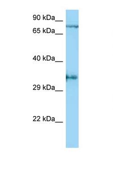 AQP4 / Aquaporin 4 Antibody - AQP4 / Aquaporin-4 antibody western blot of MDA-MB435 whole cell lysate. Antibody concentration 1 ug/ml.  This image was taken for the unconjugated form of this product. Other forms have not been tested.