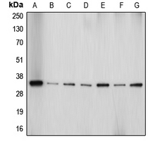 AQP4 / Aquaporin 4 Antibody - Western blot analysis of Aquaporin 4 expression in HeLa (A); Jurkat (B); PC12 (C); SP2/0 (D); HepG2 (E); U87MG (F); mouse brain (G) whole cell lysates.