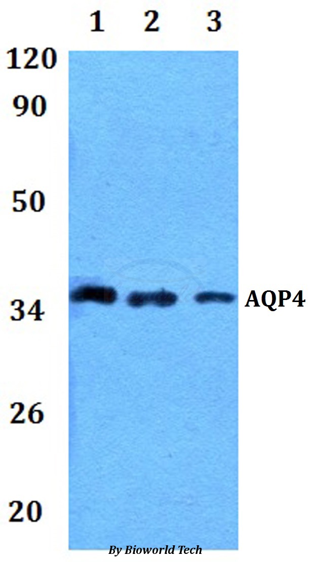 AQP4 / Aquaporin 4 Antibody - Western blot of AQP4 antibody at 1:500 dilution. Lane 1: HELA whole cell lysate. Lane 2: RAW264.7 whole cell lysate.
