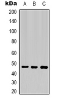 AQP4 / Aquaporin 4 Antibody - Western blot analysis of Aquaporin 4 expression in HeLa (A); mouse heart (B); rat heart (C) whole cell lysates.