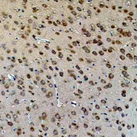 AQP4 / Aquaporin 4 Antibody - Immunohistochemical analysis of Aquaporin 4 staining in rat brain formalin fixed paraffin embedded tissue section. The section was pre-treated using heat mediated antigen retrieval with sodium citrate buffer (pH 6.0). The section was then incubated with the antibody at room temperature and detected using an HRP conjugated compact polymer system. DAB was used as the chromogen. The section was then counterstained with hematoxylin and mounted with DPX.