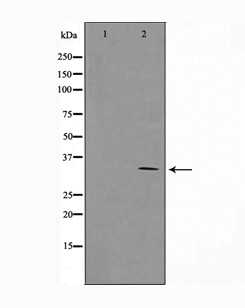 AQP4 / Aquaporin 4 Antibody - Western blot analysis of AQP4 antibody expression in rat brain tissue lysates. The lane on the left is treated with the antigen-specific peptide.