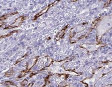 AQP4 / Aquaporin 4 Antibody - 1:100 staining human lung tissues sections by IHC-P. The tissue was formaldehyde fixed and a heat mediated antigen retrieval step in citrate buffer was performed. The tissue was then blocked and incubated with the antibody for 1.5 hours at 22°C. An HRP conjugated goat anti-rabbit antibody was used as the secondary.