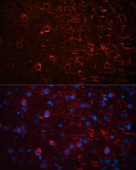 AQP4 / Aquaporin 4 Antibody - Immunofluorescence analysis of Mouse brain using Aquaporin 4 Polyclonal Antibody at dilution of 1:100 (40x lens).Blue: DAPI for nuclear staining.