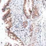 AQP4 / Aquaporin 4 Antibody - Immunohistochemistry of paraffin-embedded Rat lung using Aquaporin 4 Polyclonal Antibody at dilution of 1:100 (40x lens).