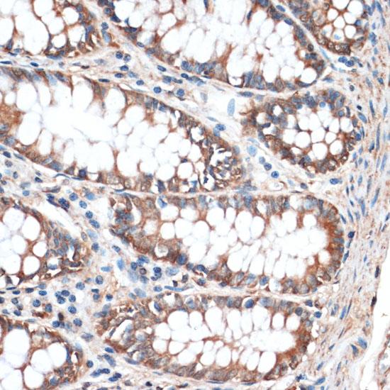 AQP4 / Aquaporin 4 Antibody - Immunohistochemistry of paraffin-embedded Human colon using Aquaporin 4 Polyclonal Antibody at dilution of 1:100 (40x lens).
