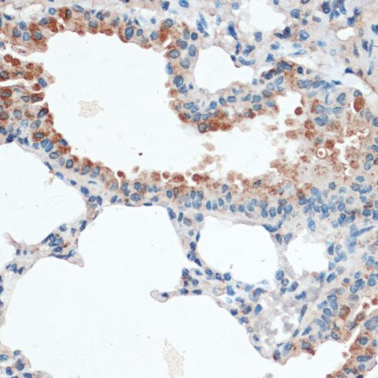 AQP4 / Aquaporin 4 Antibody - Immunohistochemistry of paraffin-embedded Mouse lung using Aquaporin 4 Polyclonal Antibody at dilution of 1:100 (40x lens).