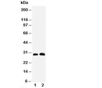 AQP5 / Aquaporin 5 Antibody - Western blot testing of Aquaporin 5 antibody and Lane 1: rat lung; 2: rat testis tissue lysate