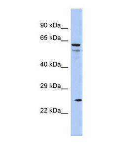 AQP5 / Aquaporin 5 Antibody - Western blot of Human COLO205. AQP5 antibody dilution 1.0 ug/ml.  This image was taken for the unconjugated form of this product. Other forms have not been tested.