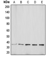 AQP5 / Aquaporin 5 Antibody - Western blot analysis of Aquaporin 5 expression in MCF7 (A); Jurkat (B); SP2/0 (C); PC12 (D); KNRK (E) whole cell lysates.