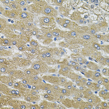 AQP5 / Aquaporin 5 Antibody - Immunohistochemistry of paraffin-embedded human liver injury tissue.