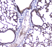 AQP5 / Aquaporin 5 Antibody - IHC analysis of Aquaporin 5 using anti-Aquaporin 5 antibody. Aquaporin 5 was detected in paraffin-embedded section of mouse lung tissue. Heat mediated antigen retrieval was performed in citrate buffer (pH6, epitope retrieval solution) for 20 mins. The tissue section was blocked with 10% goat serum. The tissue section was then incubated with 2µg/ml rabbit anti-Aquaporin 5 Antibody overnight at 4°C. Biotinylated goat anti-rabbit IgG was used as secondary antibody and incubated for 30 minutes at 37°C. The tissue section was developed using Strepavidin-Biotin-Complex (SABC) with DAB as the chromogen.