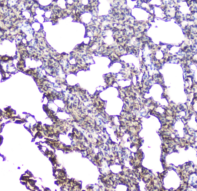 AQP5 / Aquaporin 5 Antibody - IHC analysis of Aquaporin 5 using anti-Aquaporin 5 antibody. Aquaporin 5 was detected in paraffin-embedded section of rat lung tissue. Heat mediated antigen retrieval was performed in citrate buffer (pH6, epitope retrieval solution) for 20 mins. The tissue section was blocked with 10% goat serum. The tissue section was then incubated with 2µg/ml rabbit anti-Aquaporin 5 Antibody overnight at 4°C. Biotinylated goat anti-rabbit IgG was used as secondary antibody and incubated for 30 minutes at 37°C. The tissue section was developed using Strepavidin-Biotin-Complex (SABC) with DAB as the chromogen.