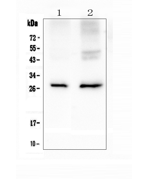 AQP5 / Aquaporin 5 Antibody - Western blot analysis of Aquaporin 5 using anti-Aquaporin 5 antibody. Electrophoresis was performed on a 5-20% SDS-PAGE gel at 70V (Stacking gel) / 90V (Resolving gel) for 2-3 hours. The sample well of each lane was loaded with 50ug of sample under reducing conditions. Lane 1: rat lung tissue lysates,Lane 2: mouse lung tissue lysates. After Electrophoresis, proteins were transferred to a Nitrocellulose membrane at 150mA for 50-90 minutes. Blocked the membrane with 5% Non-fat Milk/ TBS for 1.5 hour at RT. The membrane was incubated with rabbit anti-Aquaporin 5 antigen affinity purified polyclonal antibody at 0.5 µg/mL overnight at 4°C, then washed with TBS-0.1% Tween 3 times with 5 minutes each and probed with a goat anti-rabbit IgG-HRP secondary antibody at a dilution of 1:10000 for 1.5 hour at RT. The signal is developed using an Enhanced Chemiluminescent detection (ECL) kit with Tanon 5200 system. A specific band was detected for Aquaporin 5 at approximately 28KD. The expected band size for Aquaporin 5 is at 28KD.
