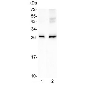 AQP5 / Aquaporin 5 Antibody - Western blot testing of 1) rat lung and 2) mouse lung lysate with AQP5 antibody at 0.5ug/ml. Predicted molecular weight ~28 kDa.