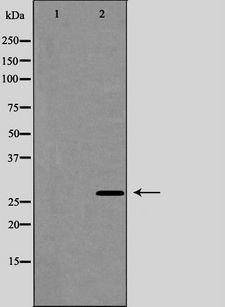 AQP5 / Aquaporin 5 Antibody - Western blot analysis of AQP5 expression in HuvEc cells. The lane on the left is treated with the antigen-specific peptide.