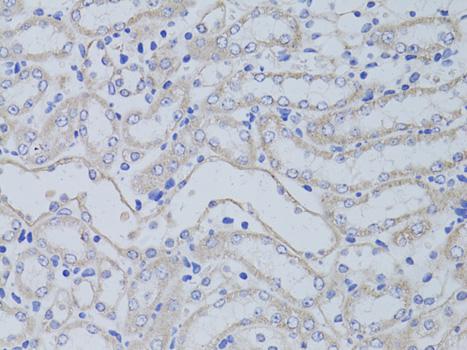 AQP5 / Aquaporin 5 Antibody - Immunohistochemistry of paraffin-embedded Mouse kidney using AQP5 Polyclonal Antibody at dilution of 1:50 (40x lens).