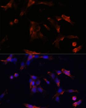 AQP5 / Aquaporin 5 Antibody - Immunofluorescence analysis of NIH/3T3 cells using AQP5 Polyclonal Antibody at dilution of 1:100.Blue: DAPI for nuclear staining.